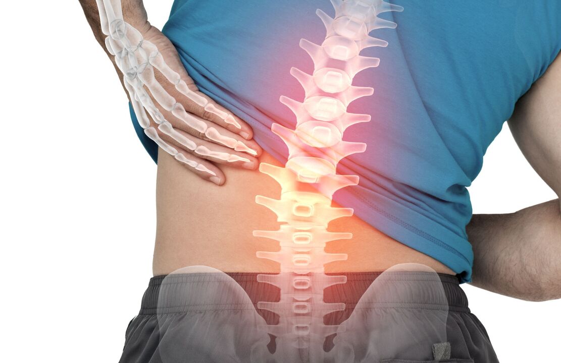 Le danger d'ostechondrose de la lombaire